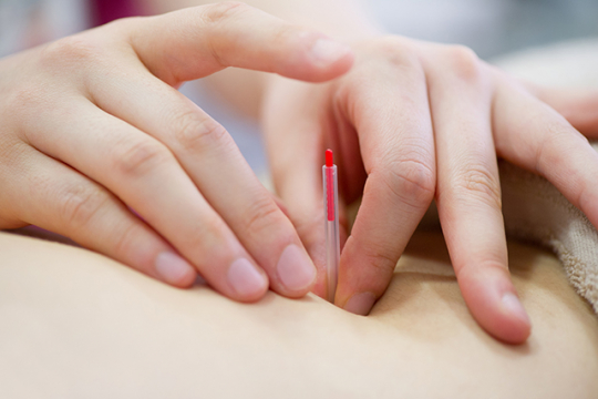 はりきゅう整体ふじ マメディテーションコースのメニュー画像