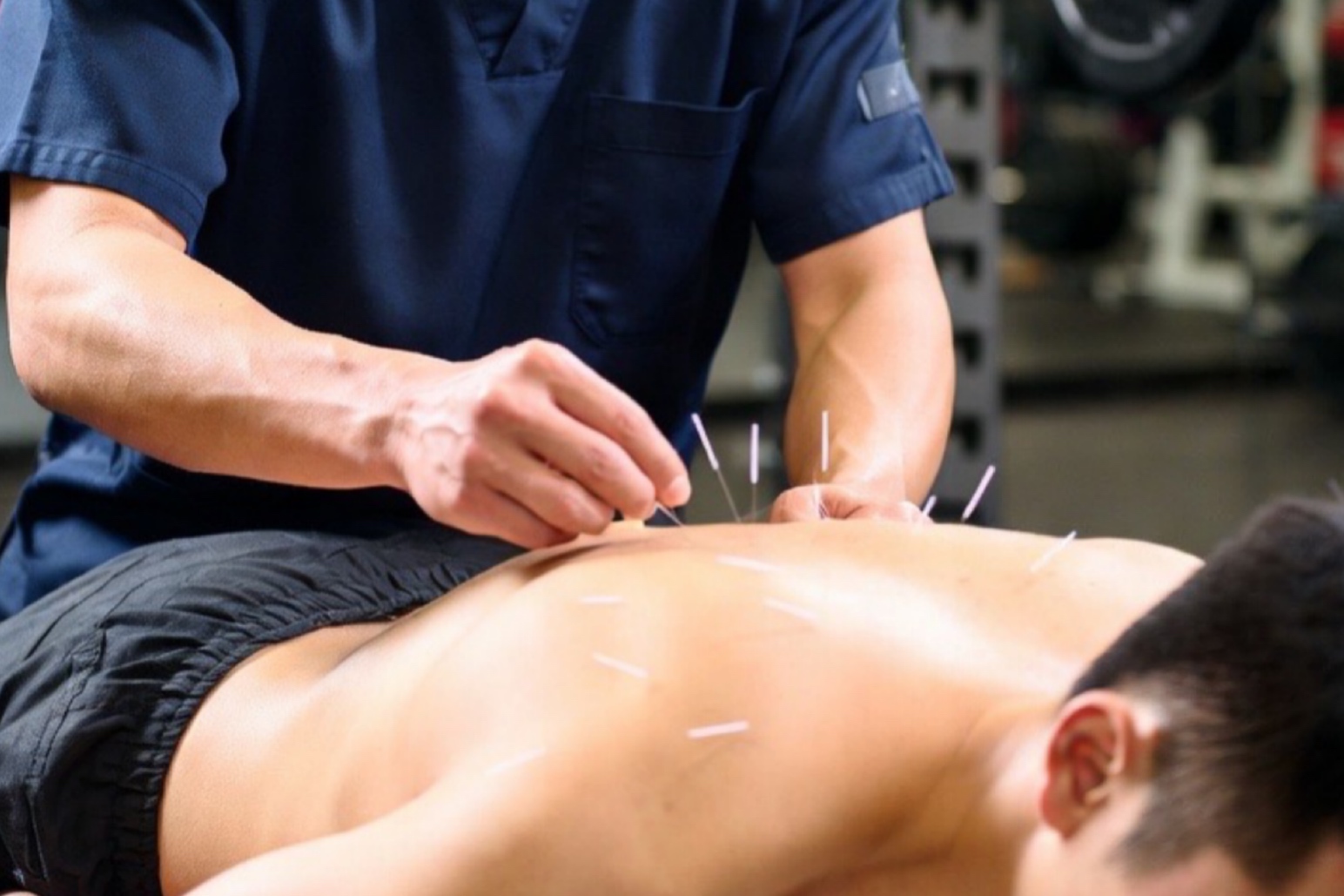 浦添てるてる鍼灸整骨院×teru.fit 60分鍼灸整体治療のメニュー画像