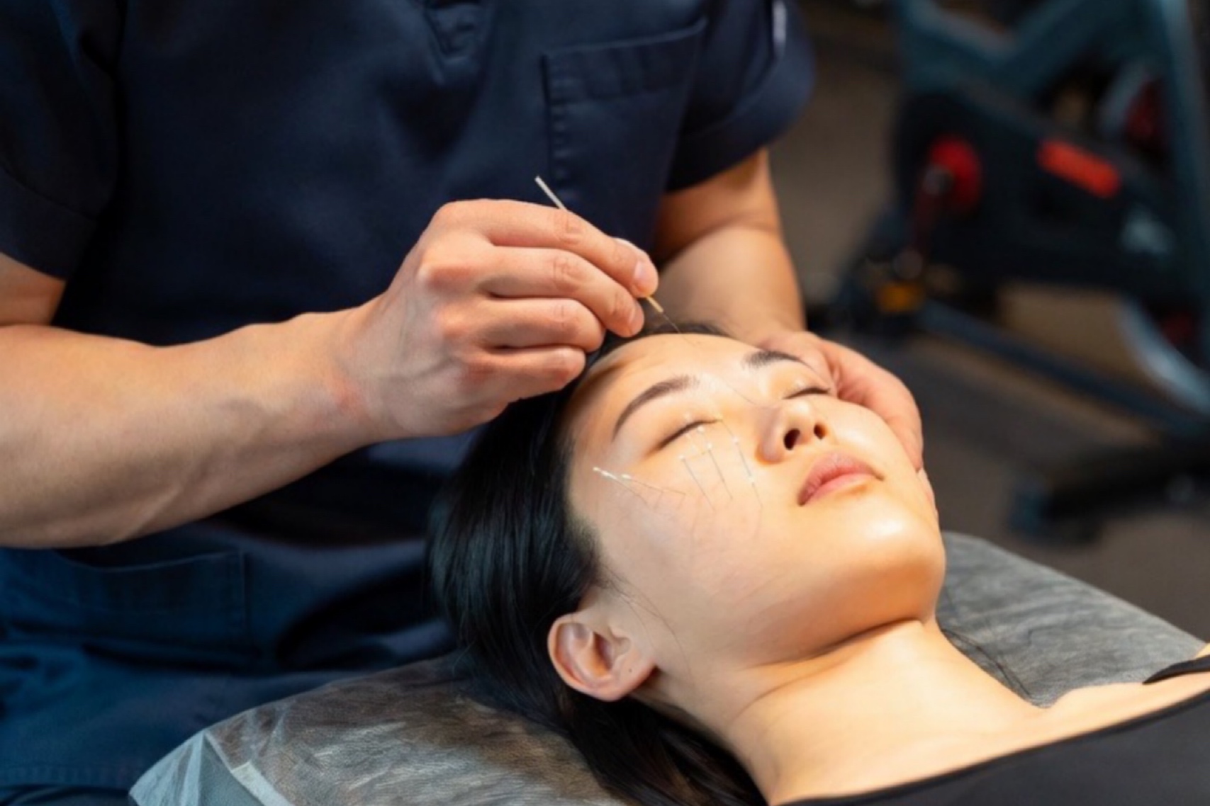 浦添てるてる鍼灸整骨院×teru.fit 美容鍼（フェイスライン肌質ケア）30分のメニュー画像