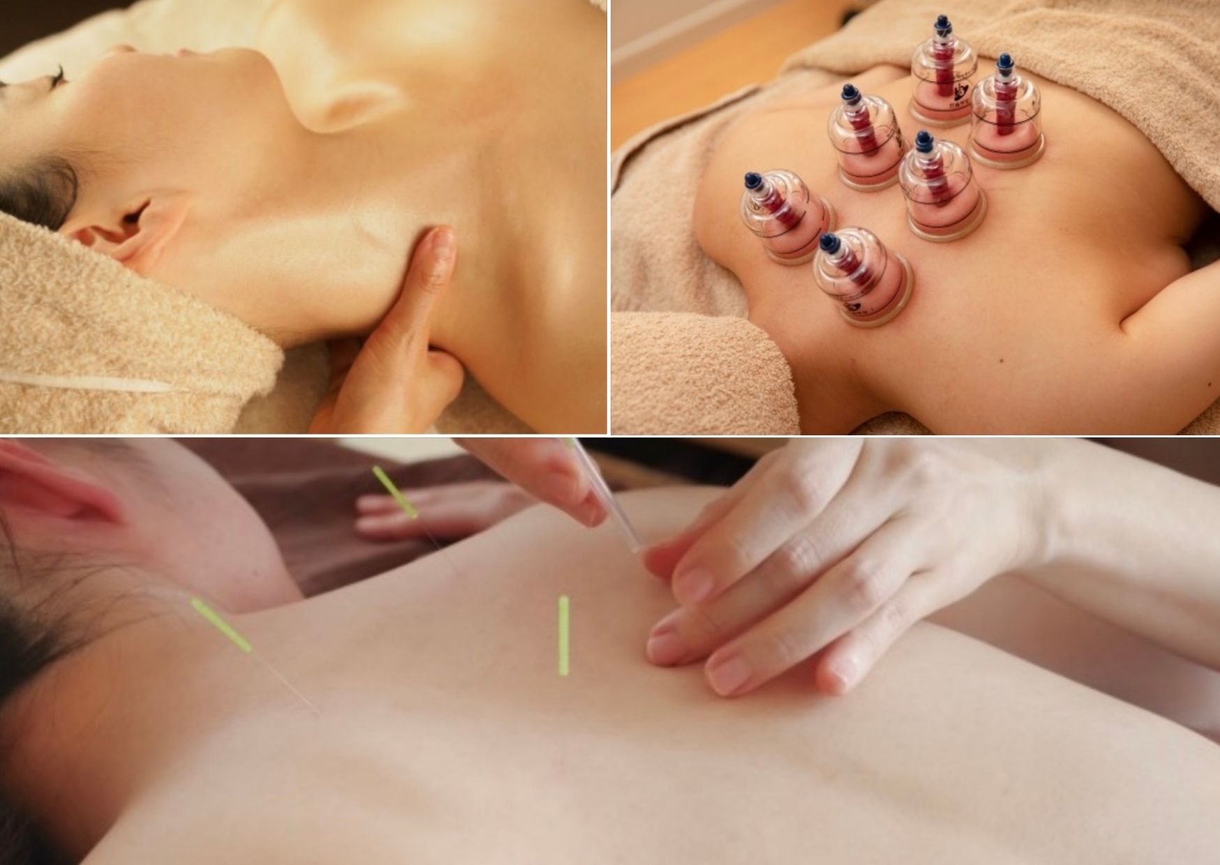 那覇鍼灸サロンrepos［ルポ］ トータルケア鍼灸70分（※身体への鍼灸）のメニュー画像