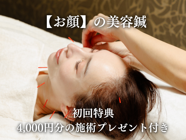 カリスタ恵比寿本店 【初めての方限定】パーフェクトリフトケア美容鍼（お顔）のメニュー画像