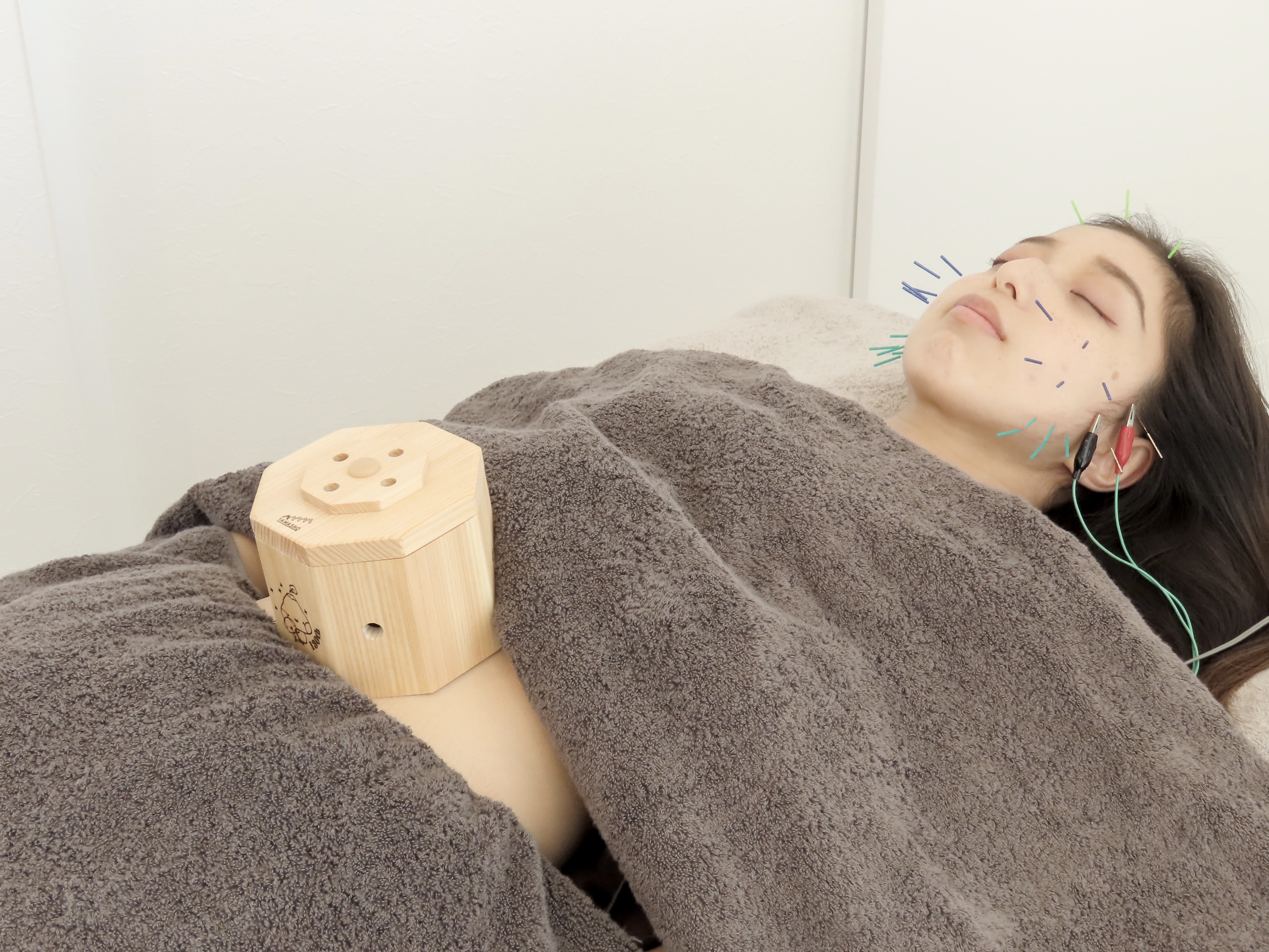 Ruria鍼灸サロン 【プレミアムフルコース】美容鍼×全身鍼灸 90分 15,500円→(初回)9,900円のメニュー画像