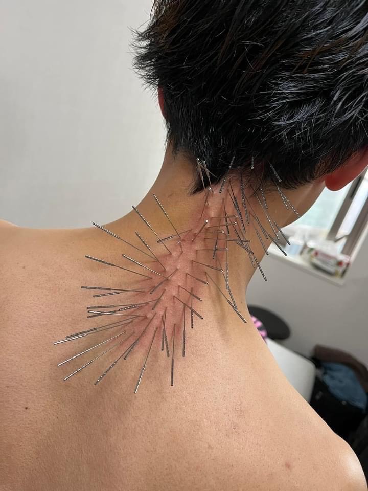 ここゆ鍼灸院 部分治療30分のメニュー画像