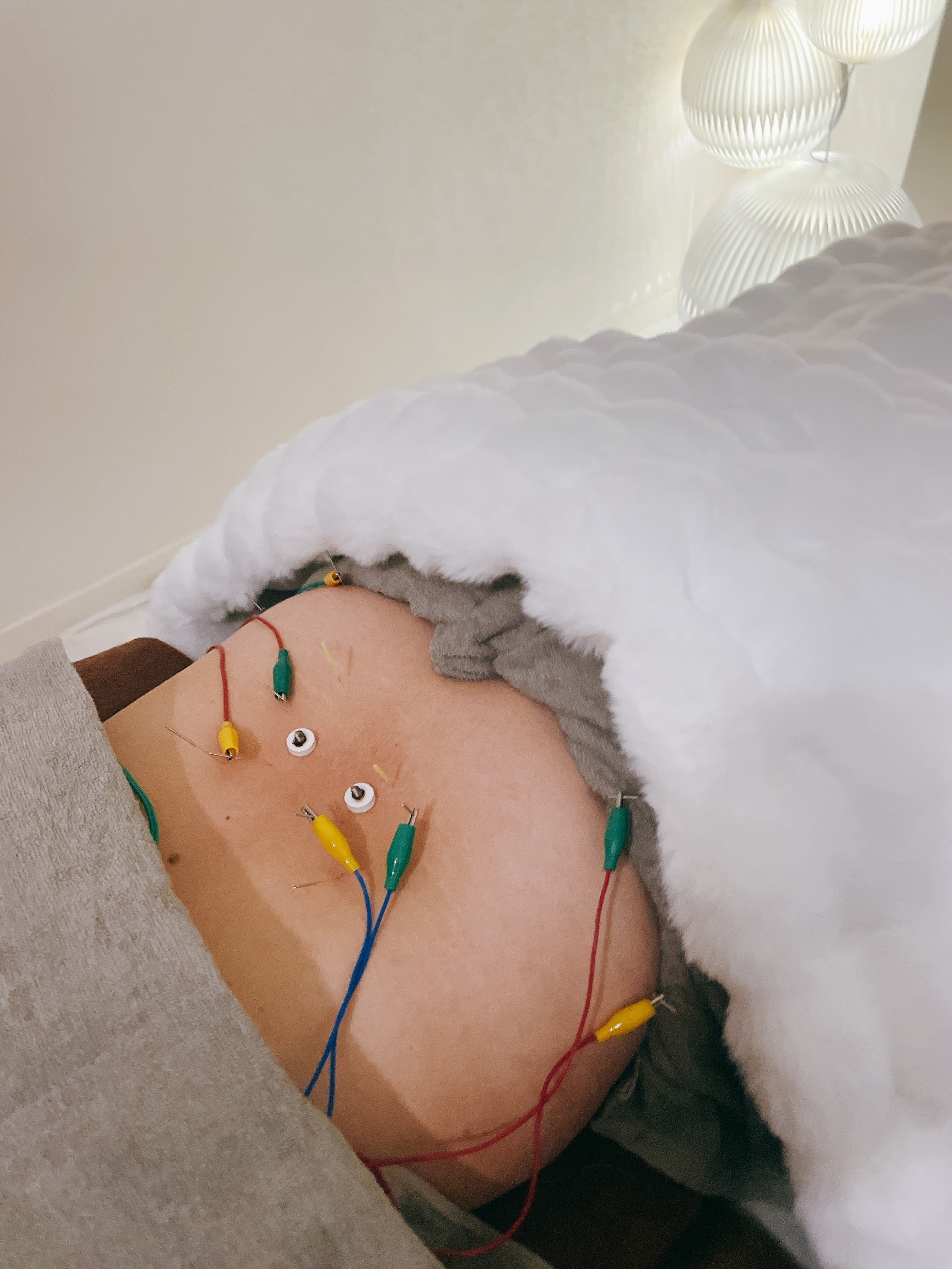 soie. (ソワ) 腰痛の整体+鍼灸治療のメニュー画像