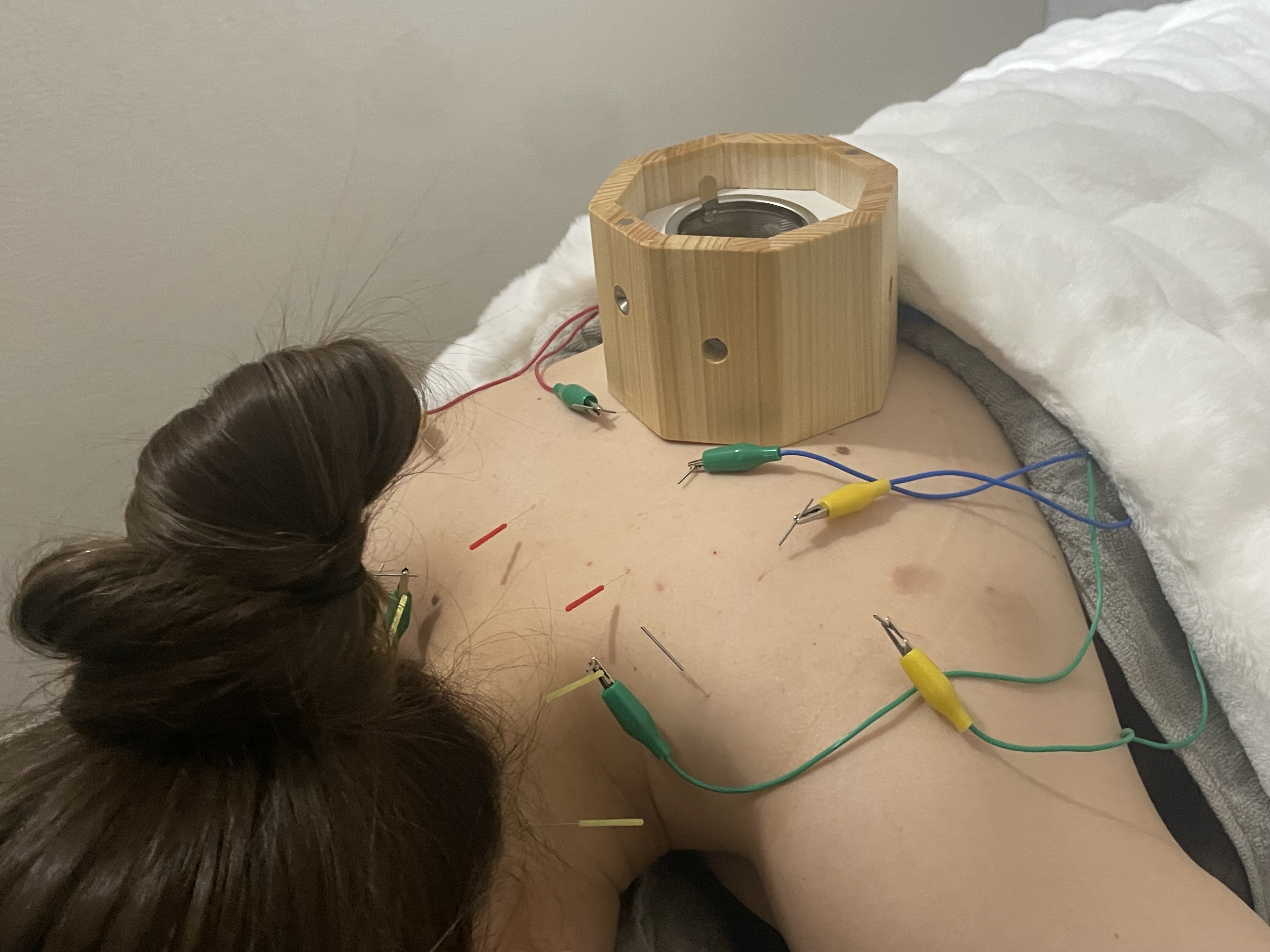 soie. (ソワ) 肩こりへ整体+鍼灸治療のメニュー画像