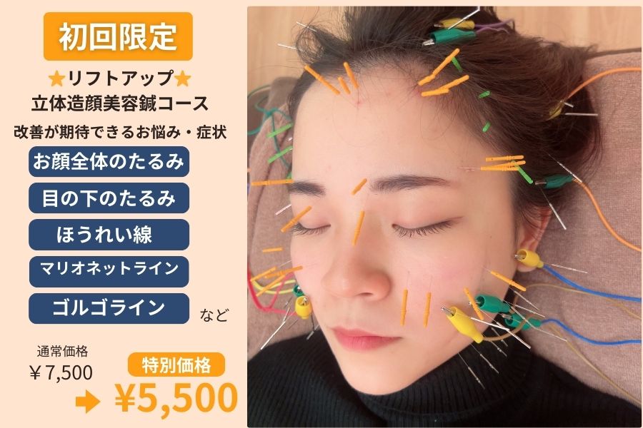 美容鍼・はりきゅうサロン　笑陽堂  ⭐︎リフトアップ⭐︎立体造顔美容鍼コース¥7,500→初回限定¥5,500（来店時次回予約で3ヶ月間   1回¥6,000)のメニュー画像