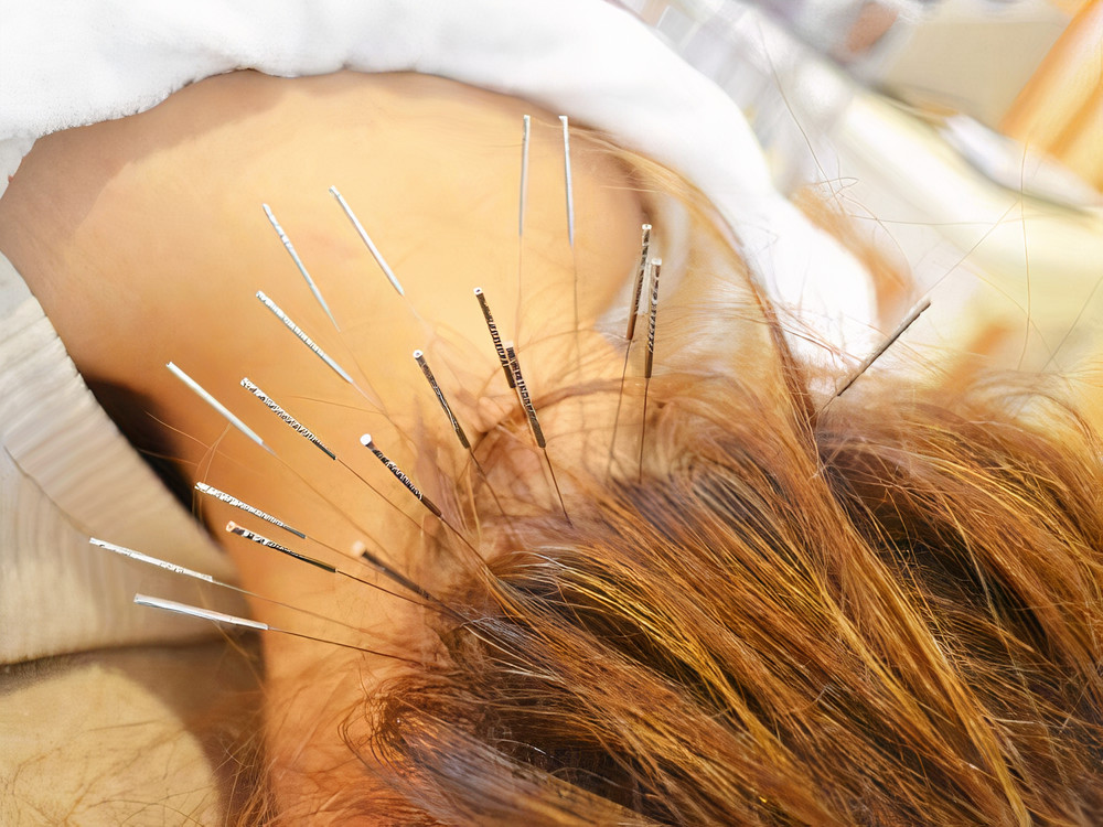 鍼処SHIRAKAWAなごや院千種【ルート治療専門院】 ルート鍼初体験コース２０分【毎月５名限定・身体の施術のみ】のメニュー画像