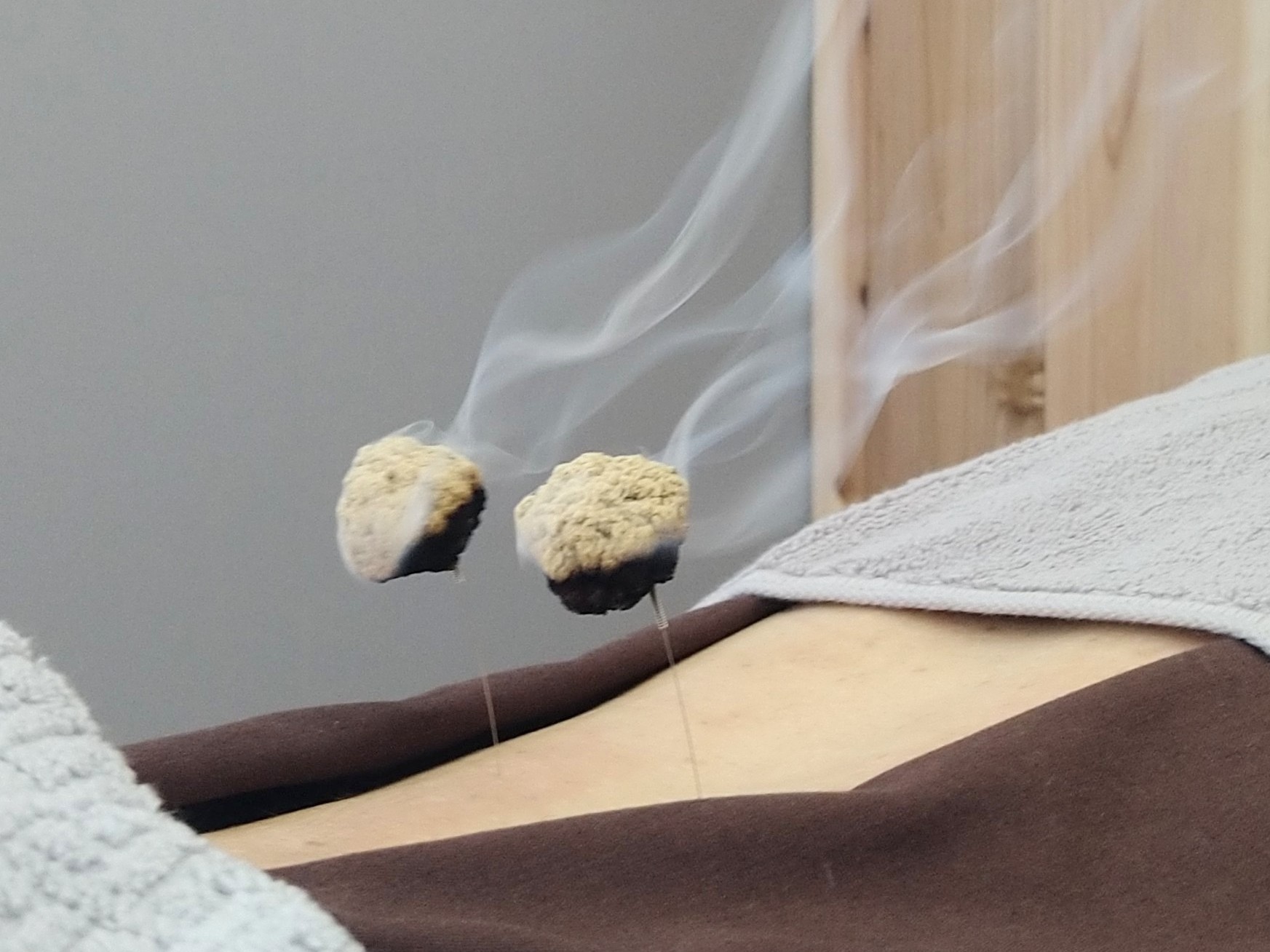 みずいろ鍼灸 全身治療+灸頭鍼　　（鍼灸治療の経験ありの方対象）　※のメニュー画像