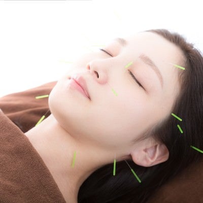 鍼灸マッサージ治療室ともさんち 美容鍼20本のメニュー画像