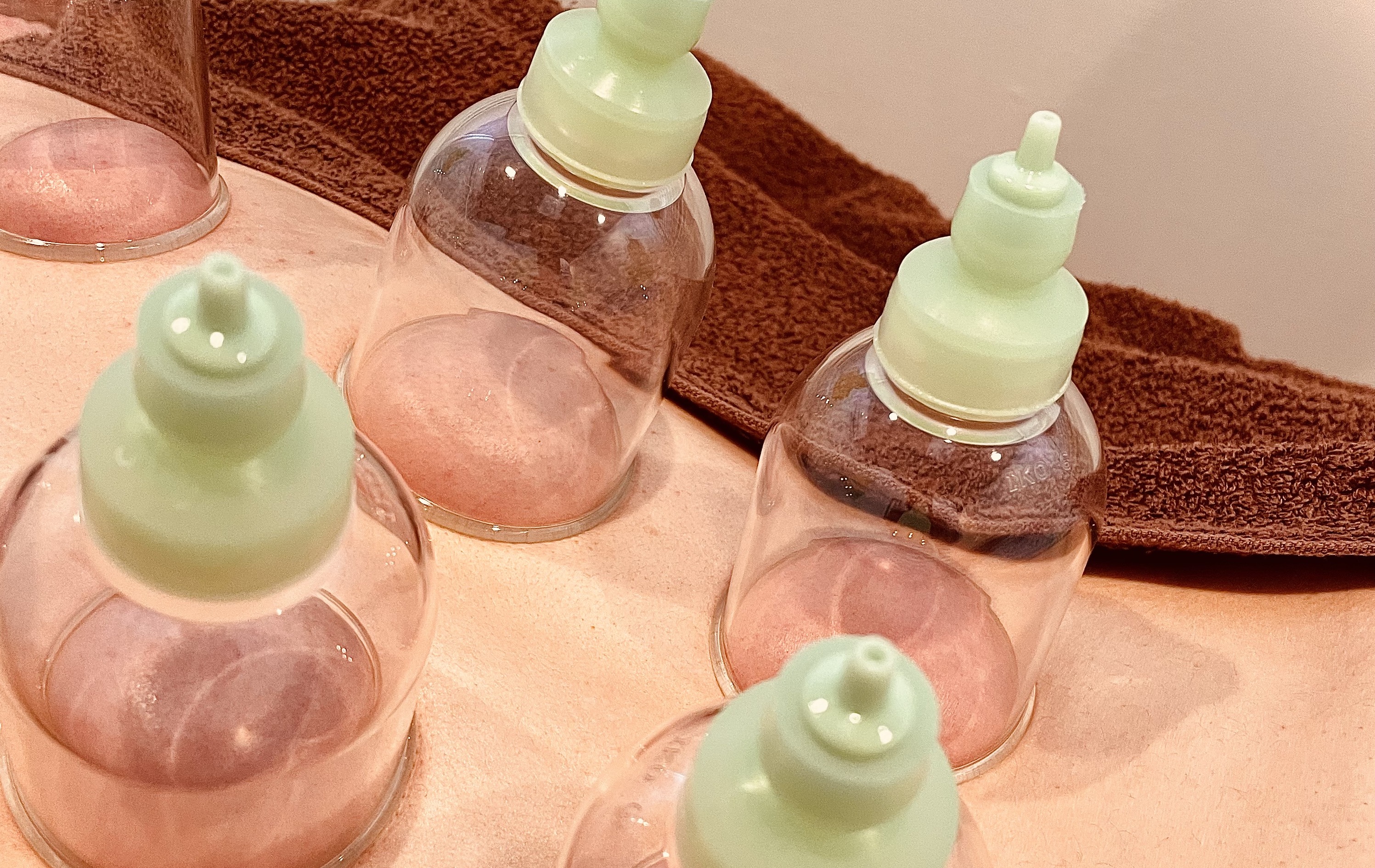 長岡京　季　鍼灸院 コンディショニング カッピングプラス　のメニュー画像