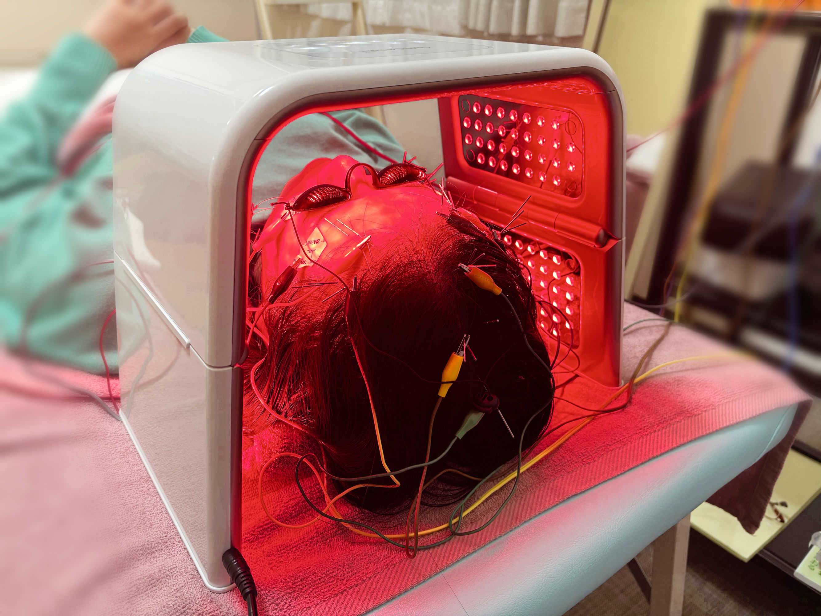 ごほう美鍼灸院 電気美容鍼+光エステコースのメニュー画像