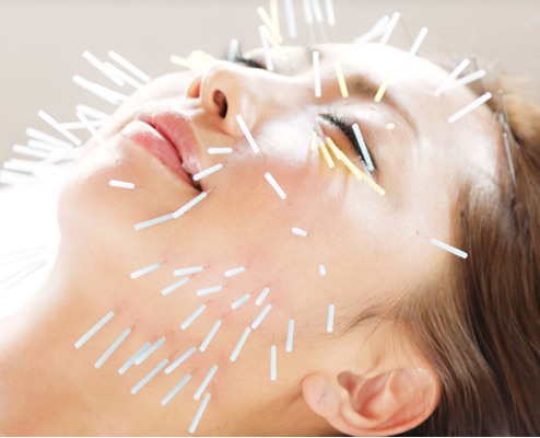 輝林鍼灸治療院 美容鍼＋生薬パックのメニュー画像