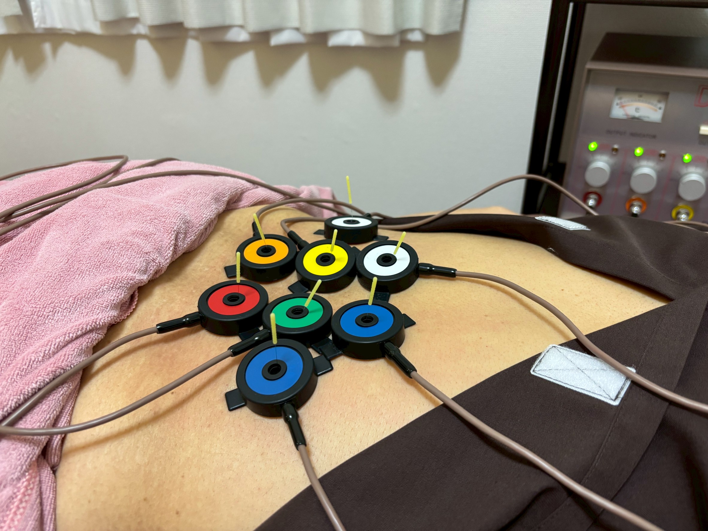 ごほう美鍼灸院 肩こり・腰痛にお悩みの方へ！しんきゅうコースのメニュー画像