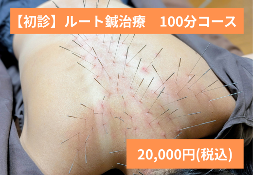 はり灸マッサージSOLE LUNA 【はじめての方】ルート鍼（多鍼）治療100分　改善効果：BESTのメニュー画像