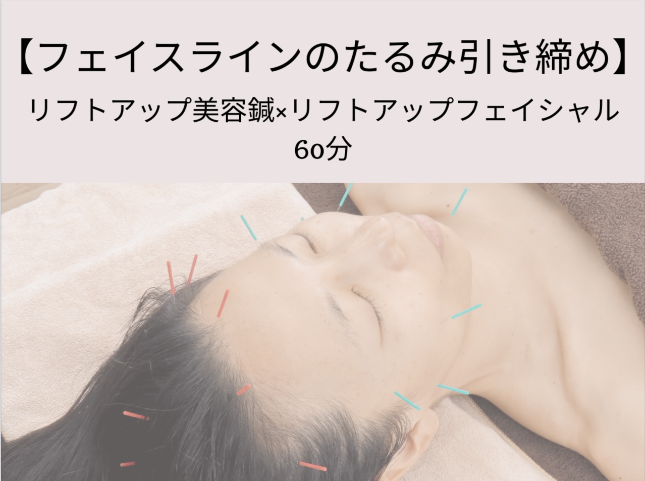 はりきゅう治療院トゥルーカラーズ 【初回限定】フェイスラインのたるみ引き締め　美容鍼フェイシャル60分のメニュー画像