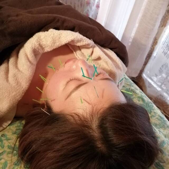 古民家Kanaloa ★全身美容鍼灸★のメニュー画像