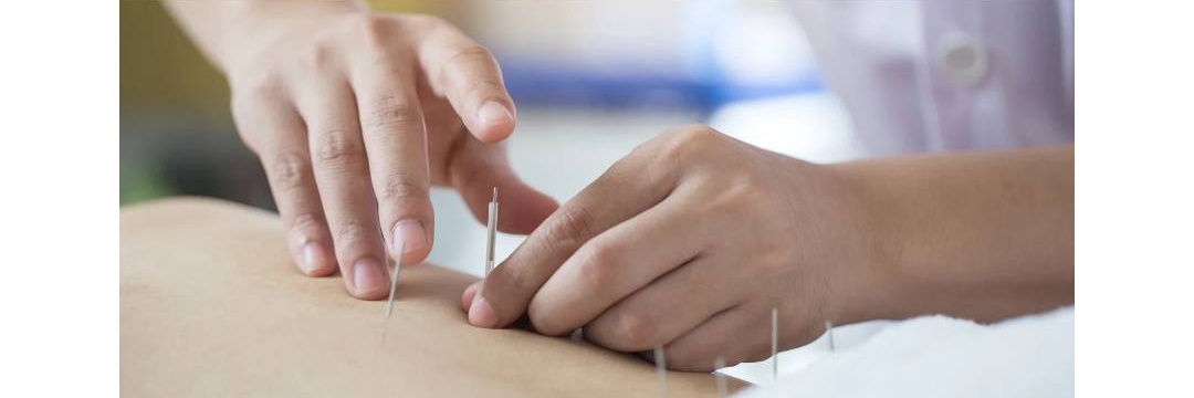 心美鍼灸院 基本鍼灸にプラスのメニュー画像