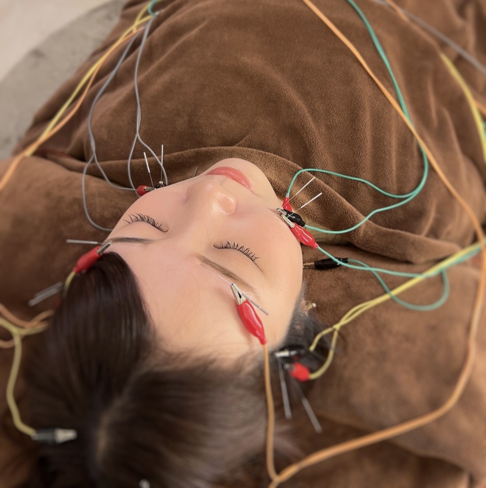 コトハリ 【新規✨】電気を流す美容鍼 60分のメニュー画像