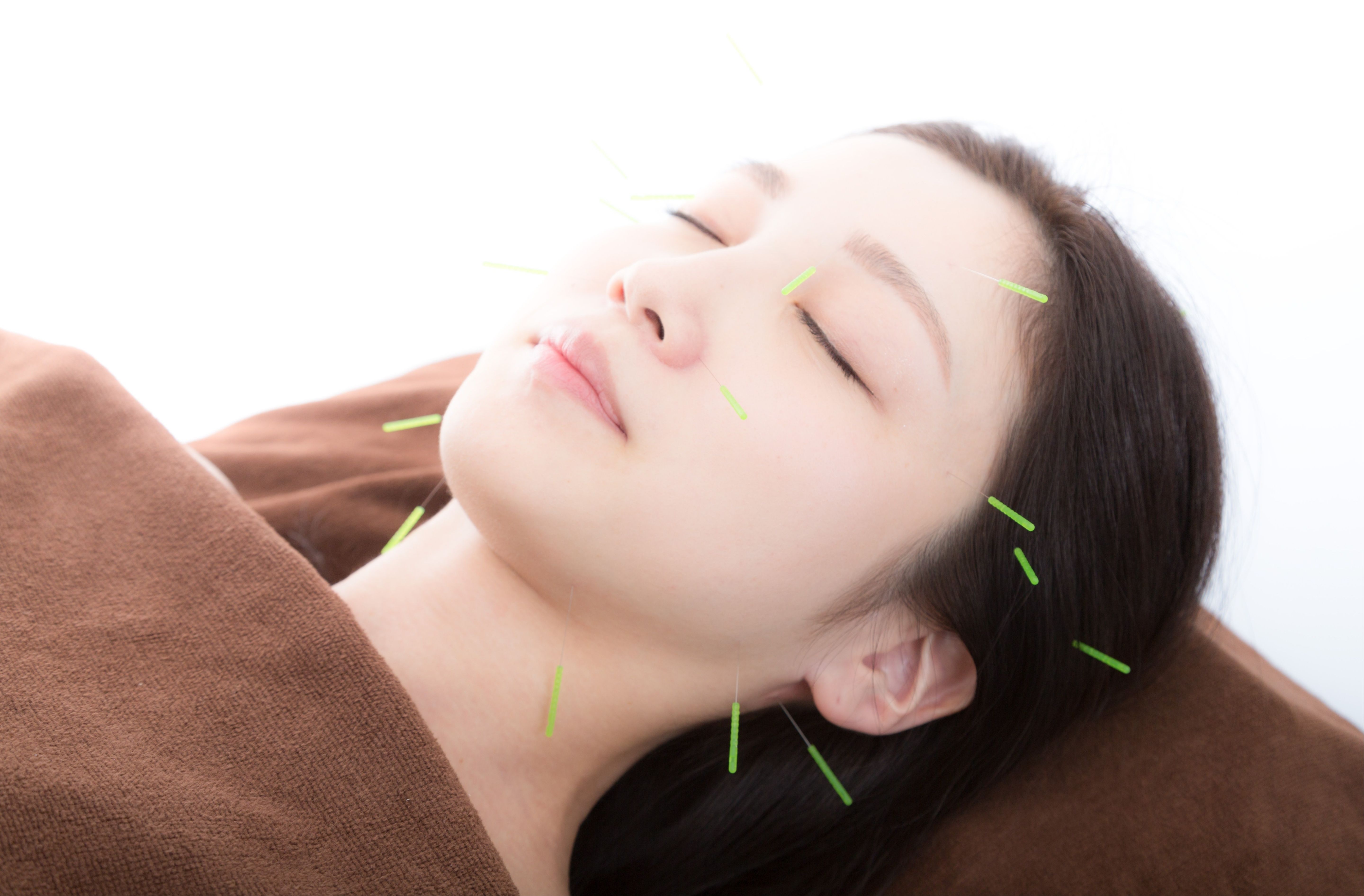 越谷HELM鍼灸整体院 【2回目以降】姿勢から美しくなる美容鍼のメニュー画像