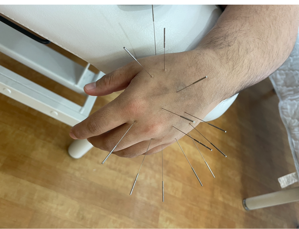 やまもと鍼灸整骨院(ルート治療）和泉市 部分施術【筋膜整体ショート・鍼ショート・２回目以降の方】のメニュー画像