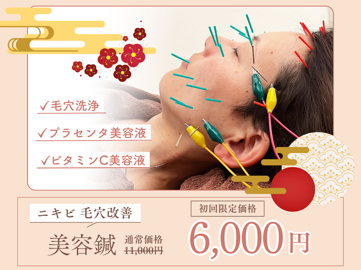 鍼灸×整体　salon i 【ニキビ・毛穴改善】美容鍼　60分　6,000円のメニュー画像