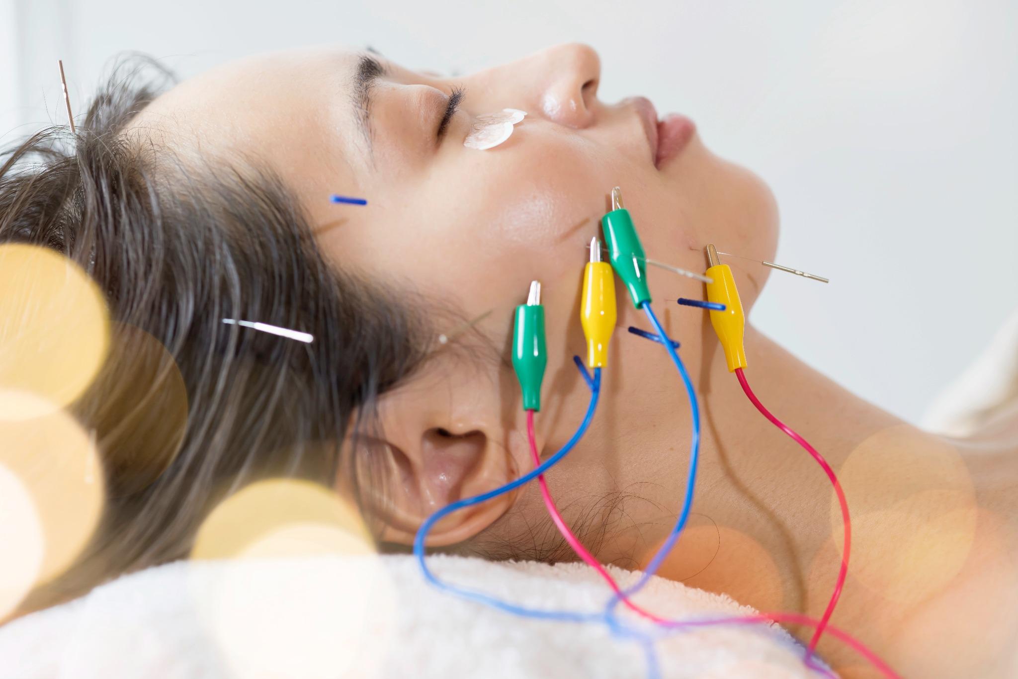 たくみ鍼灸院 美容鍼　小顔・たるみケア（初めての方限定）のメニュー画像