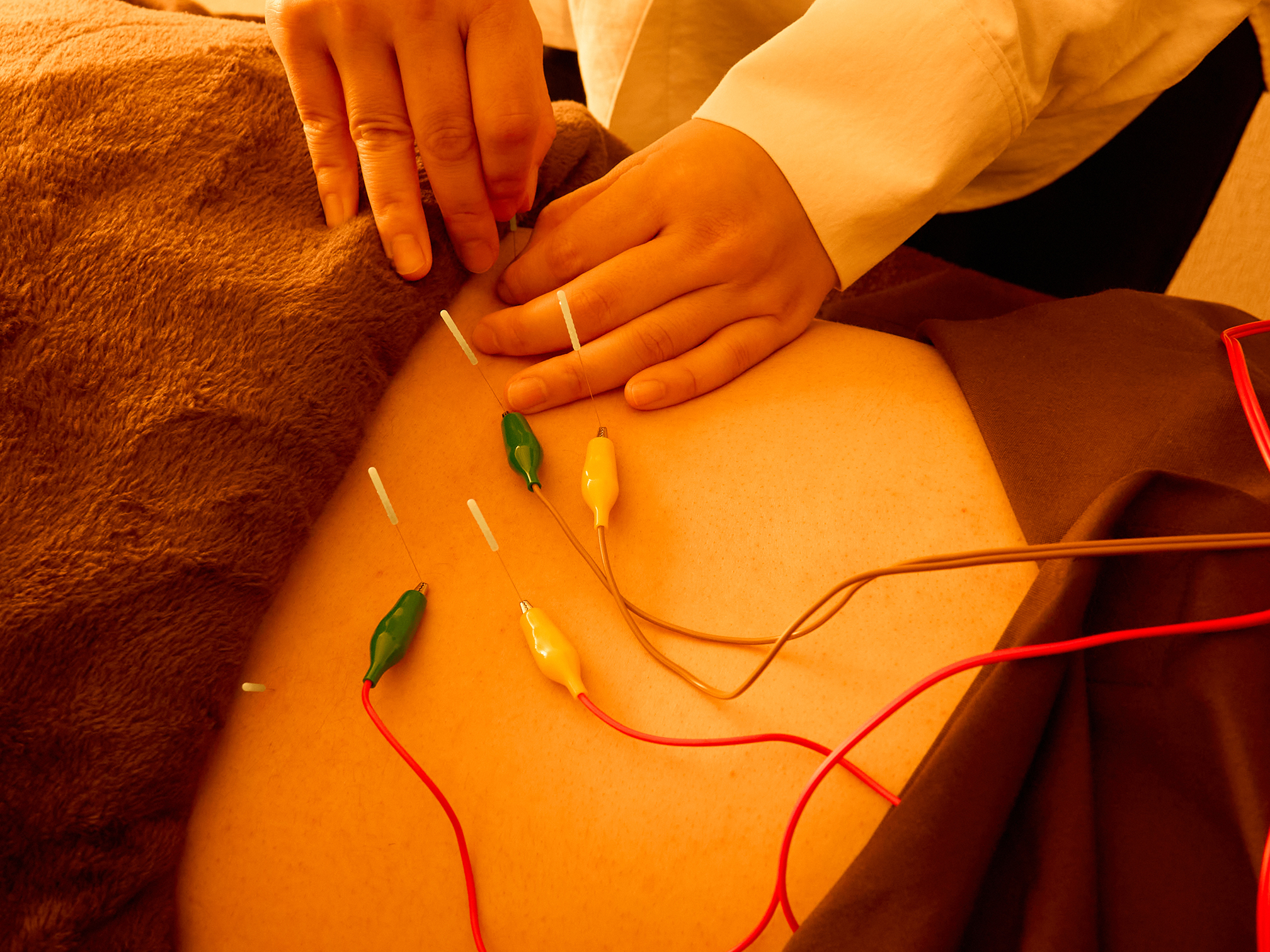 プライベート鍼灸サロン十三 【初回90分 完全オーダーメイド鍼灸】￥7,500-のメニュー画像