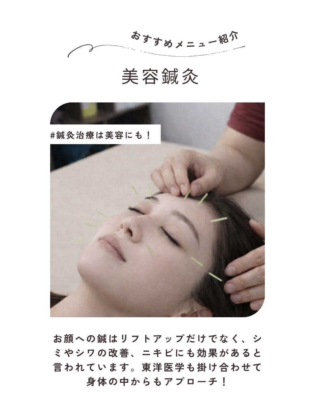 湯結鍼灸院 美容コース(美容鍼灸＋ヘッドマッサージ)のメニュー画像