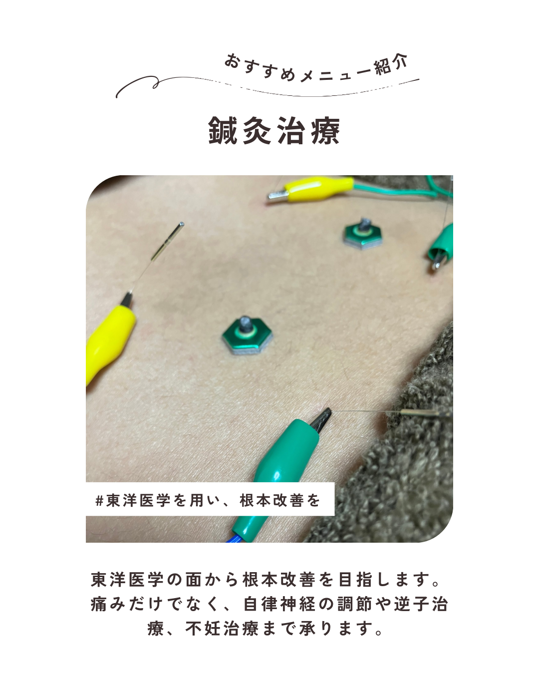 湯結鍼灸院 疲労回復コース(鍼一部位＋もみほぐし)のメニュー画像