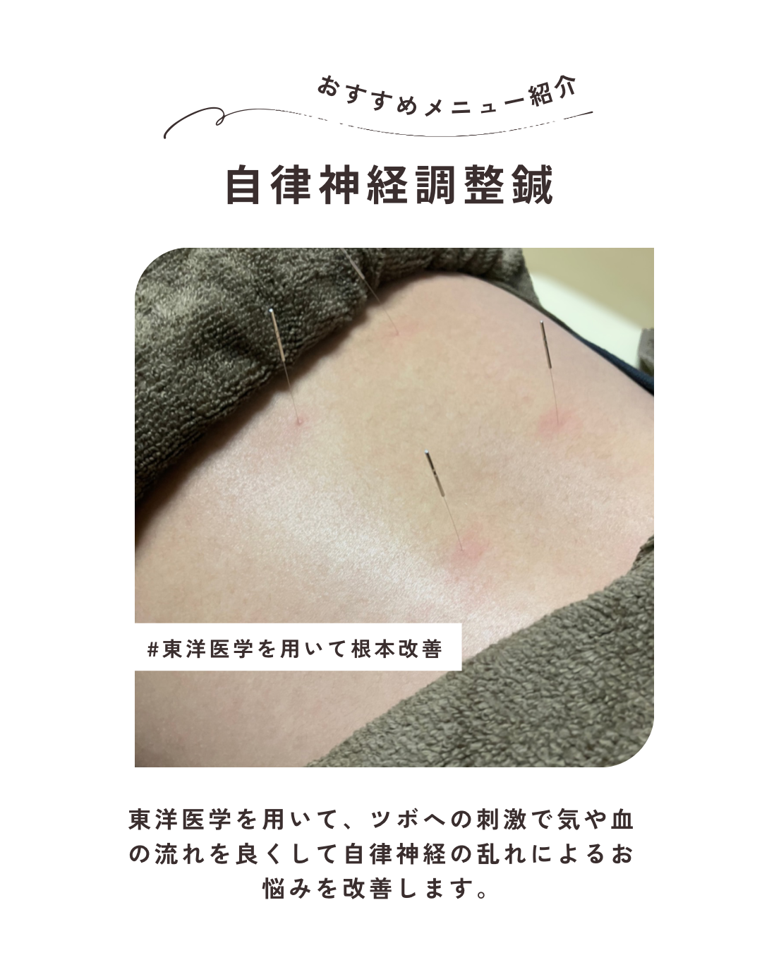 湯結鍼灸院 自律神経調整コース(自律神経調整鍼＋もみほぐし)のメニュー画像