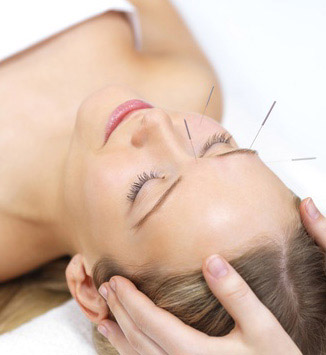 Solavi鍼灸サロン 《初回限定》美容鍼＋小顔矯正＋ヘッドマッサージのメニュー画像