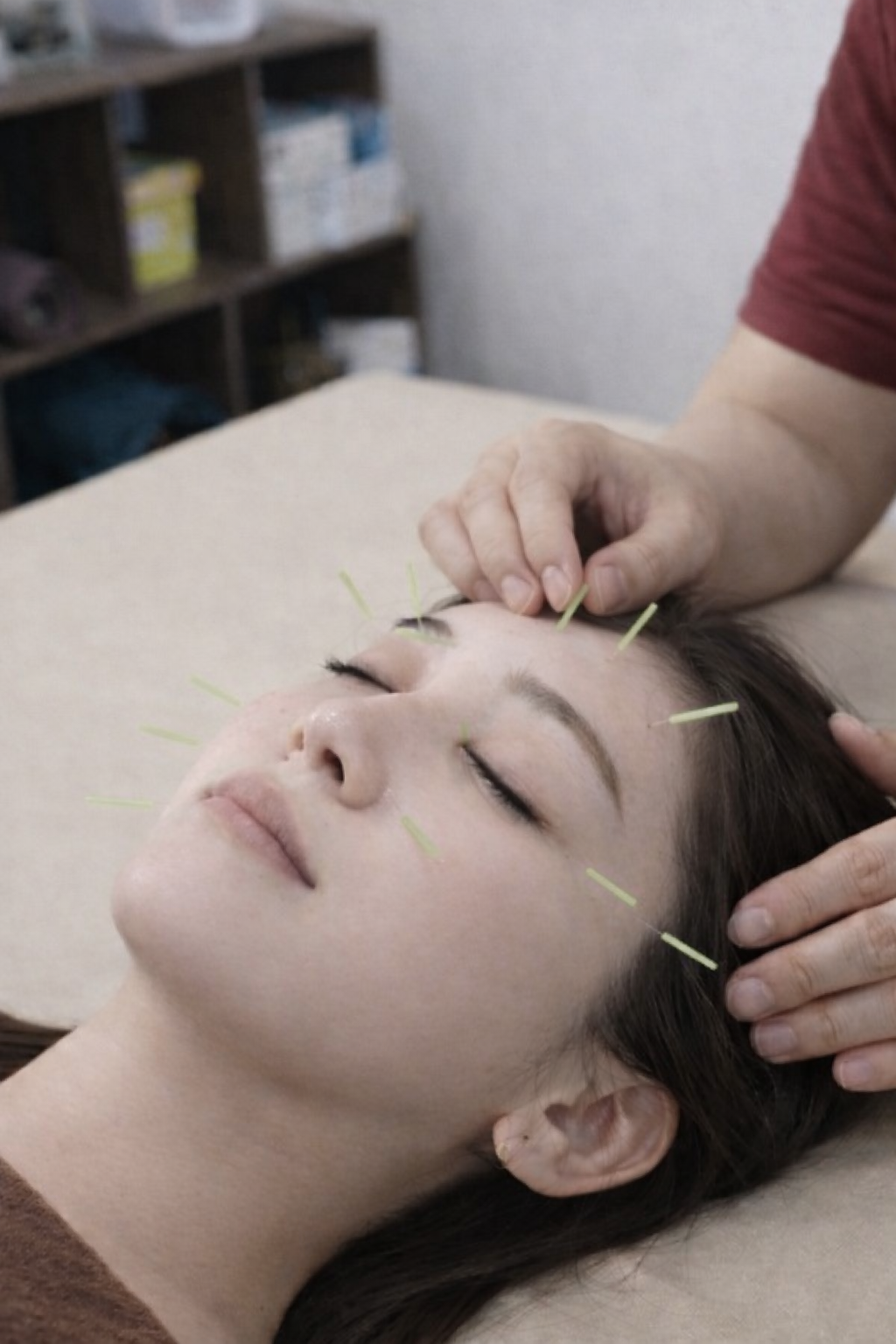 湯結鍼灸院 美容鍼灸のメニュー画像