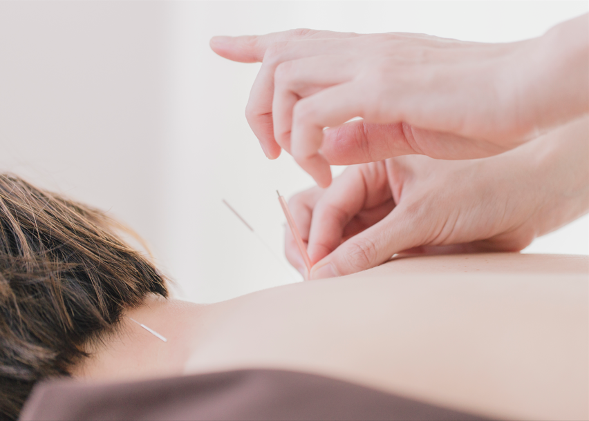 ７０１　鍼灸マッサージ院 鍼：疲れとストレスを抱えるあなたへのメニュー画像