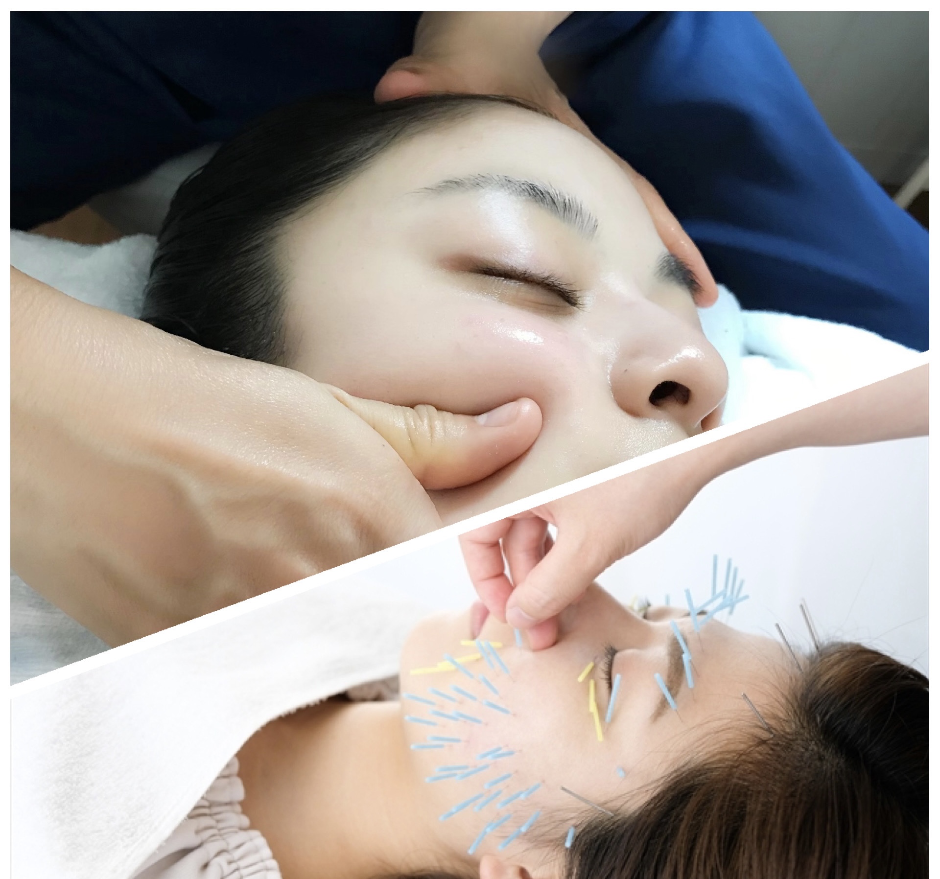 かんのん鍼灸院 🍑美容鍼＆コルギで最強小顔に🍑のメニュー画像