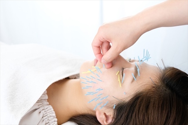 かんのん鍼灸院 🍑リフトアップ美容鍼🍑のメニュー画像