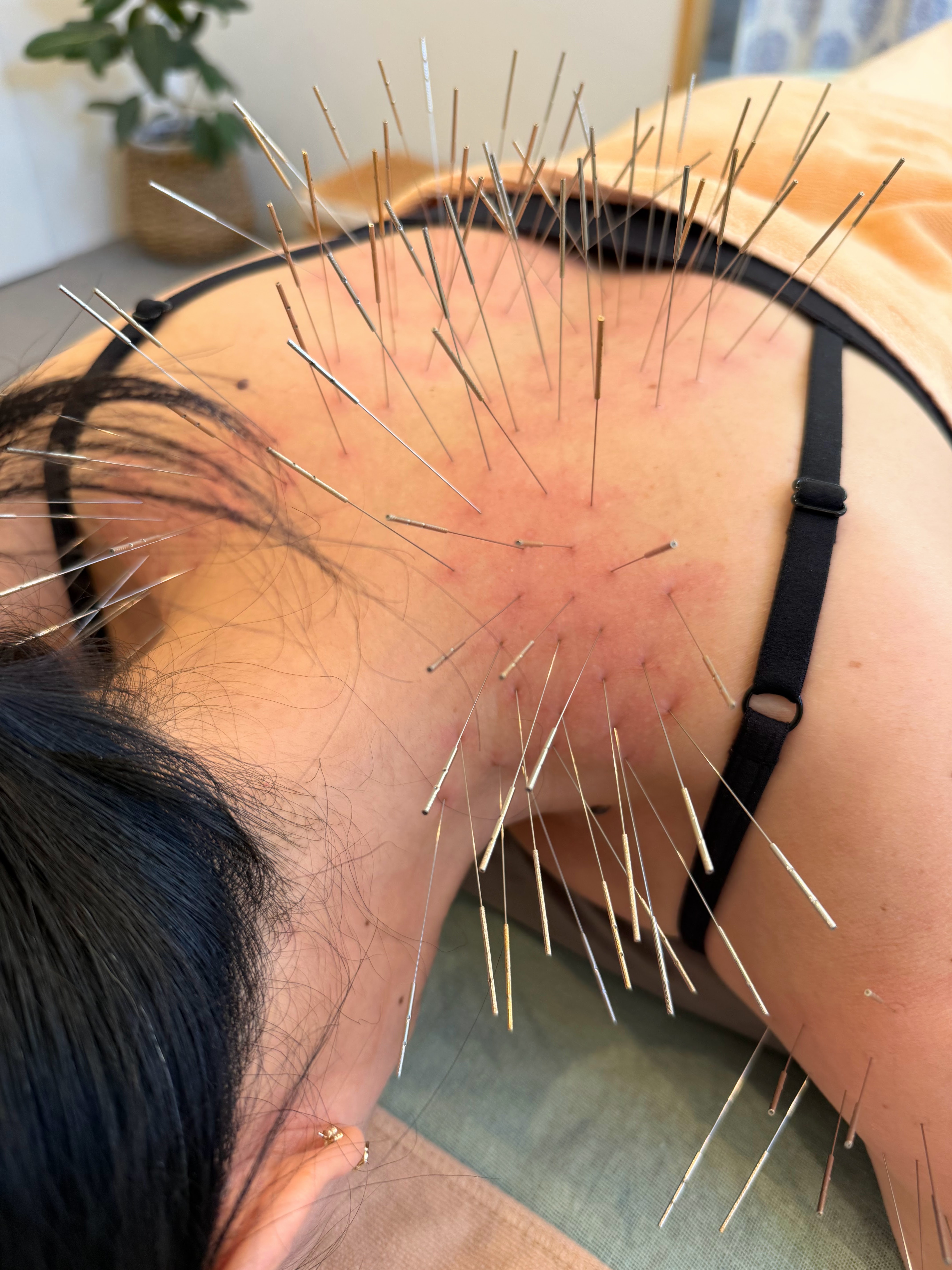 寿貴鍼灸院【ルート治療専門院】 80分コースのメニュー画像