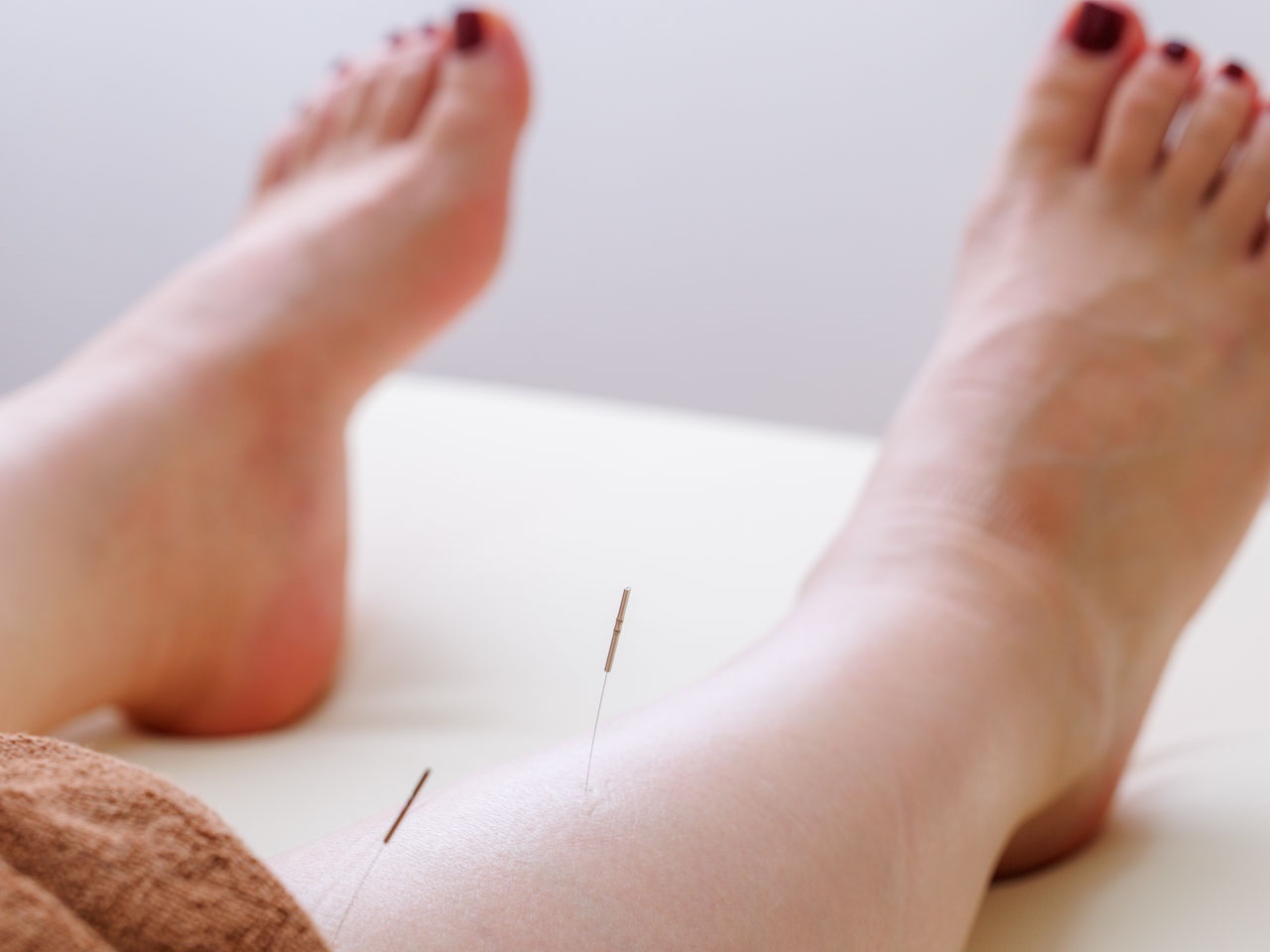 楓の杜鍼灸院 【心と身体を満たすフルコース】全身鍼＋小顔美容鍼＋整体のメニュー画像