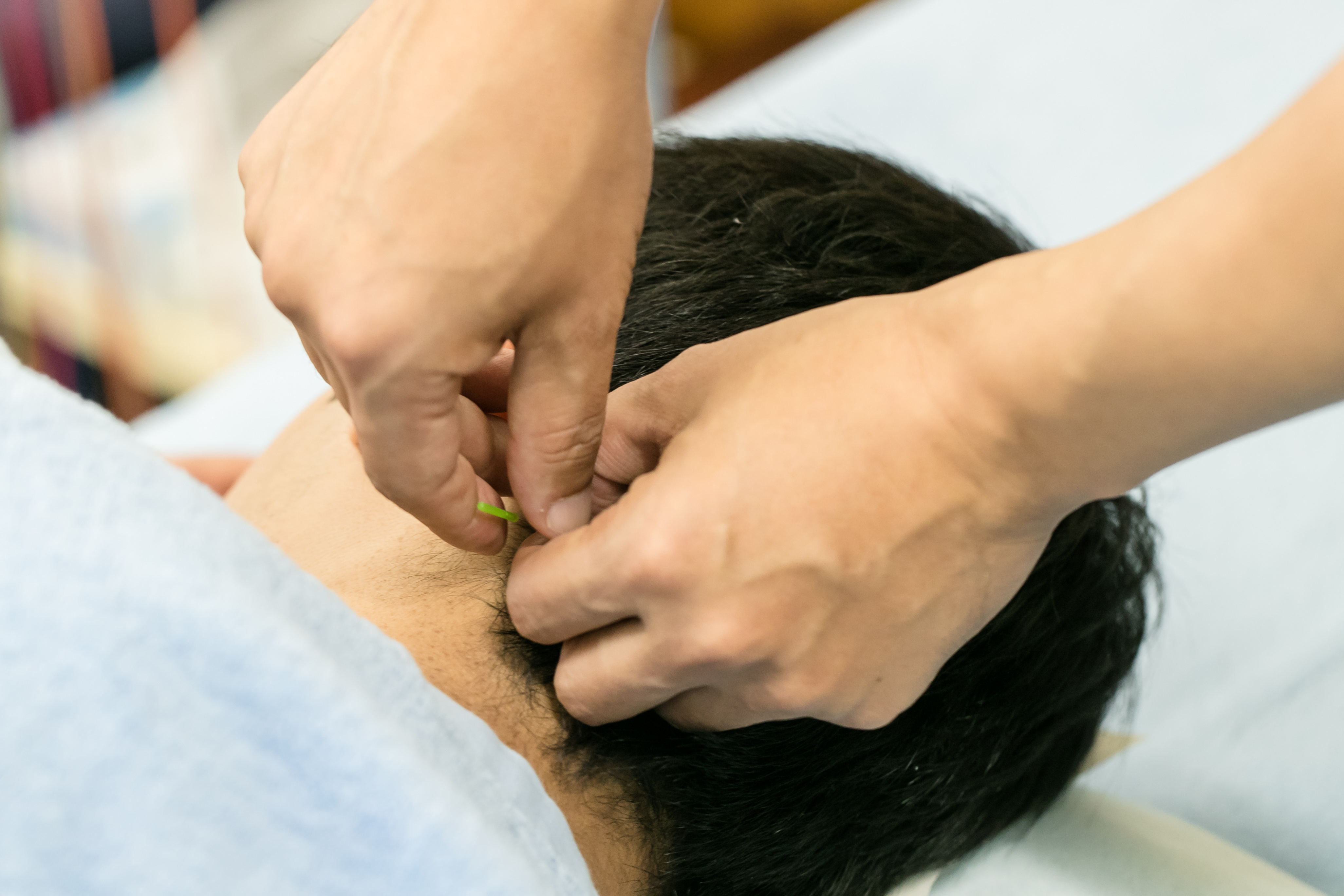 なばな鍼灸院（剛鍼灸院グループ） 頭痛・偏頭痛　初診のメニュー画像