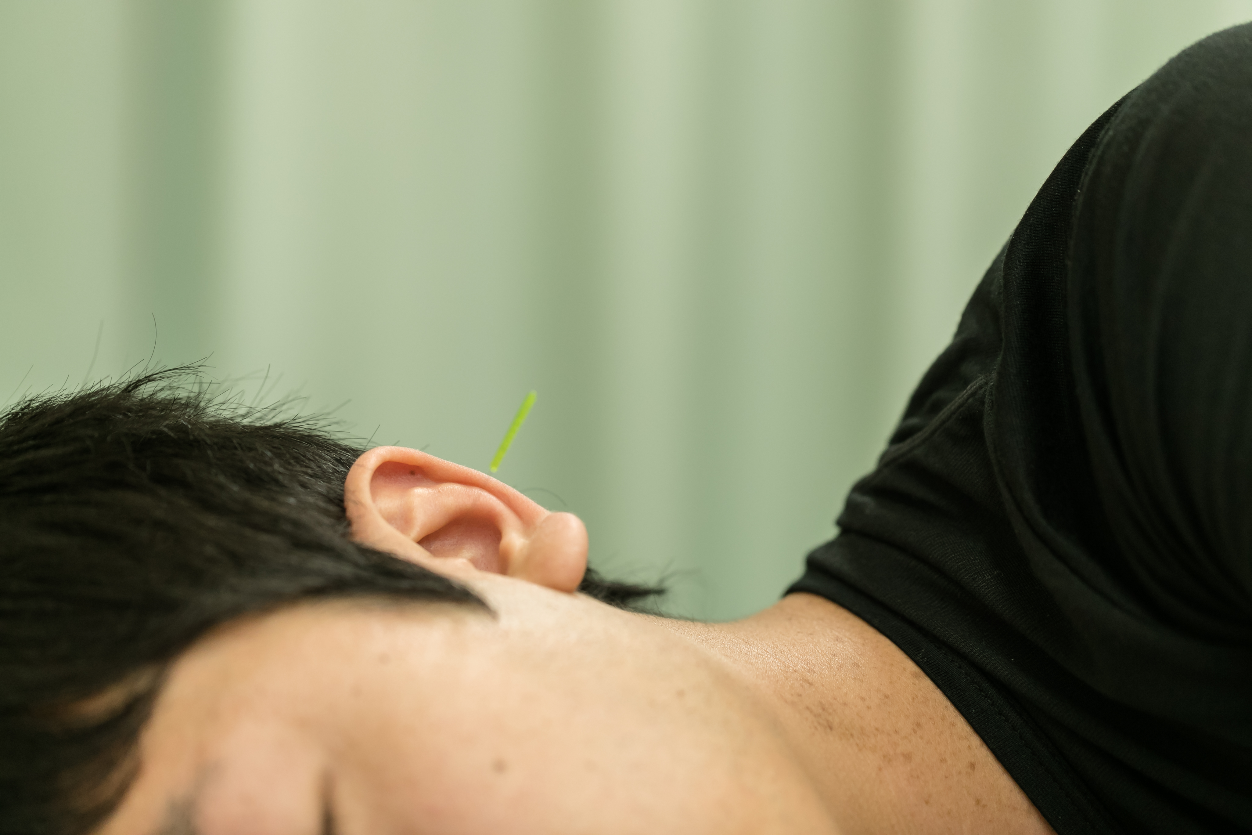 なばな鍼灸院（剛鍼灸院グループ） 難聴、めまい、メニエール病　初診のメニュー画像