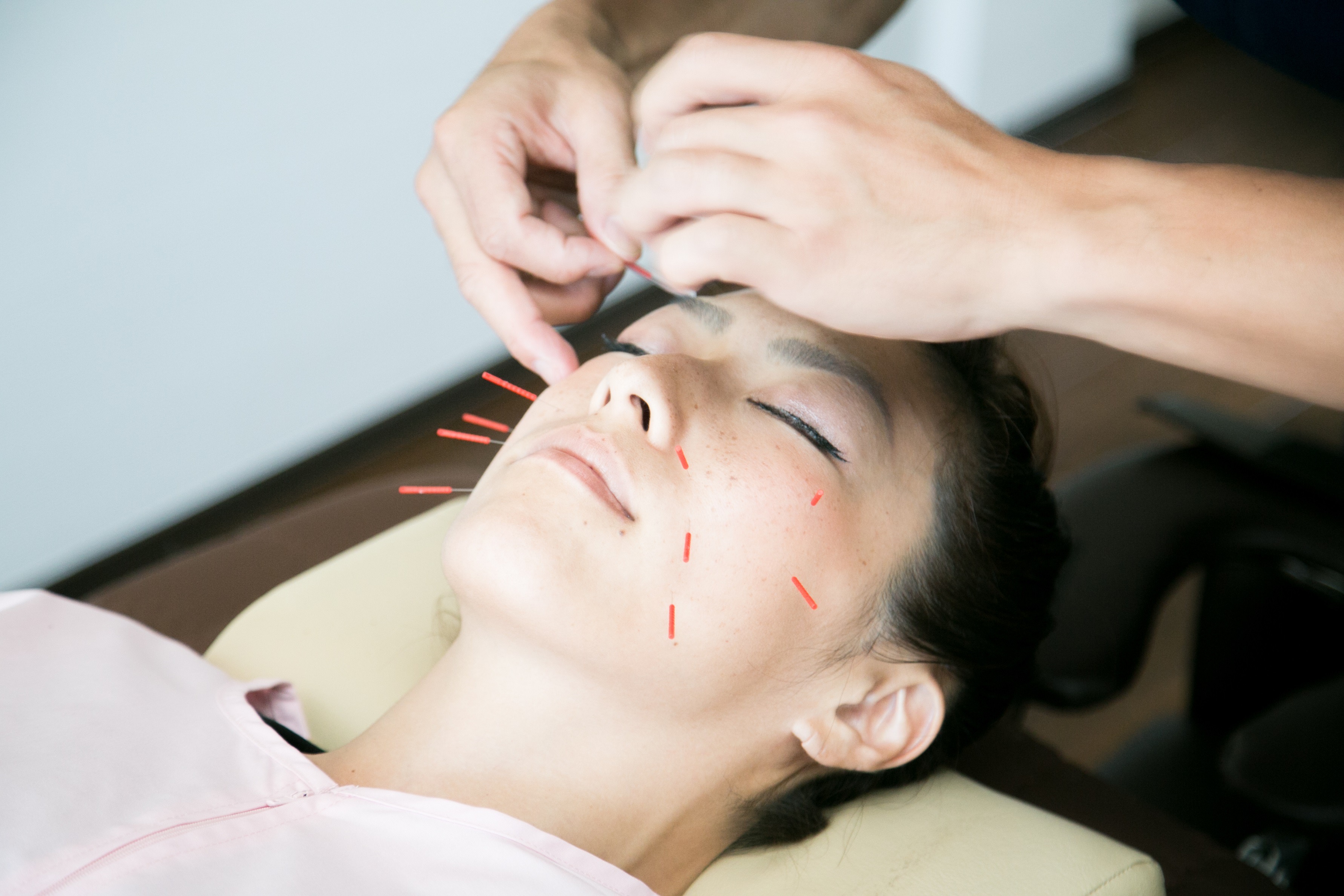 雪ノ下治療院 美顔鍼40分のメニュー画像