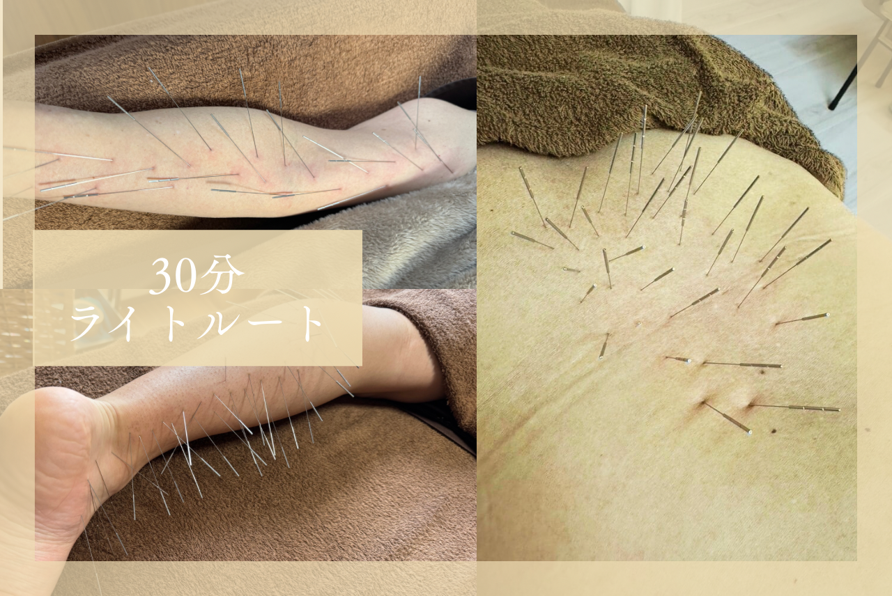 ひめの鍼灸院 博多大濠 根っこピンポイント整え 30分のメニュー画像