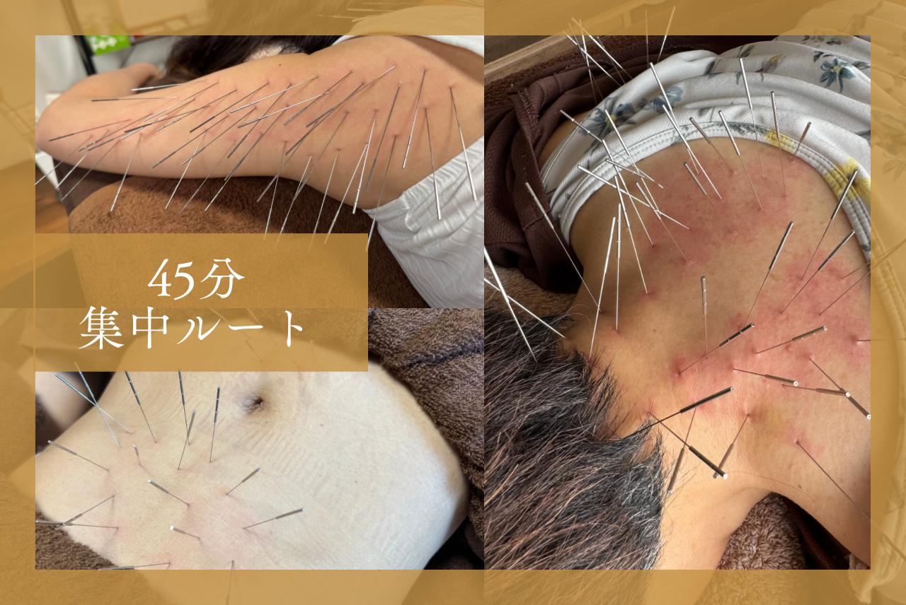 ひめの鍼灸院 博多大濠 集中ルートケア 45分のメニュー画像