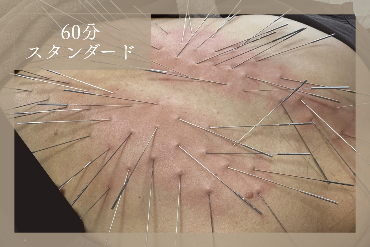 ひめの鍼灸院 博多大濠 内から整う全身ルート　60分のメニュー画像