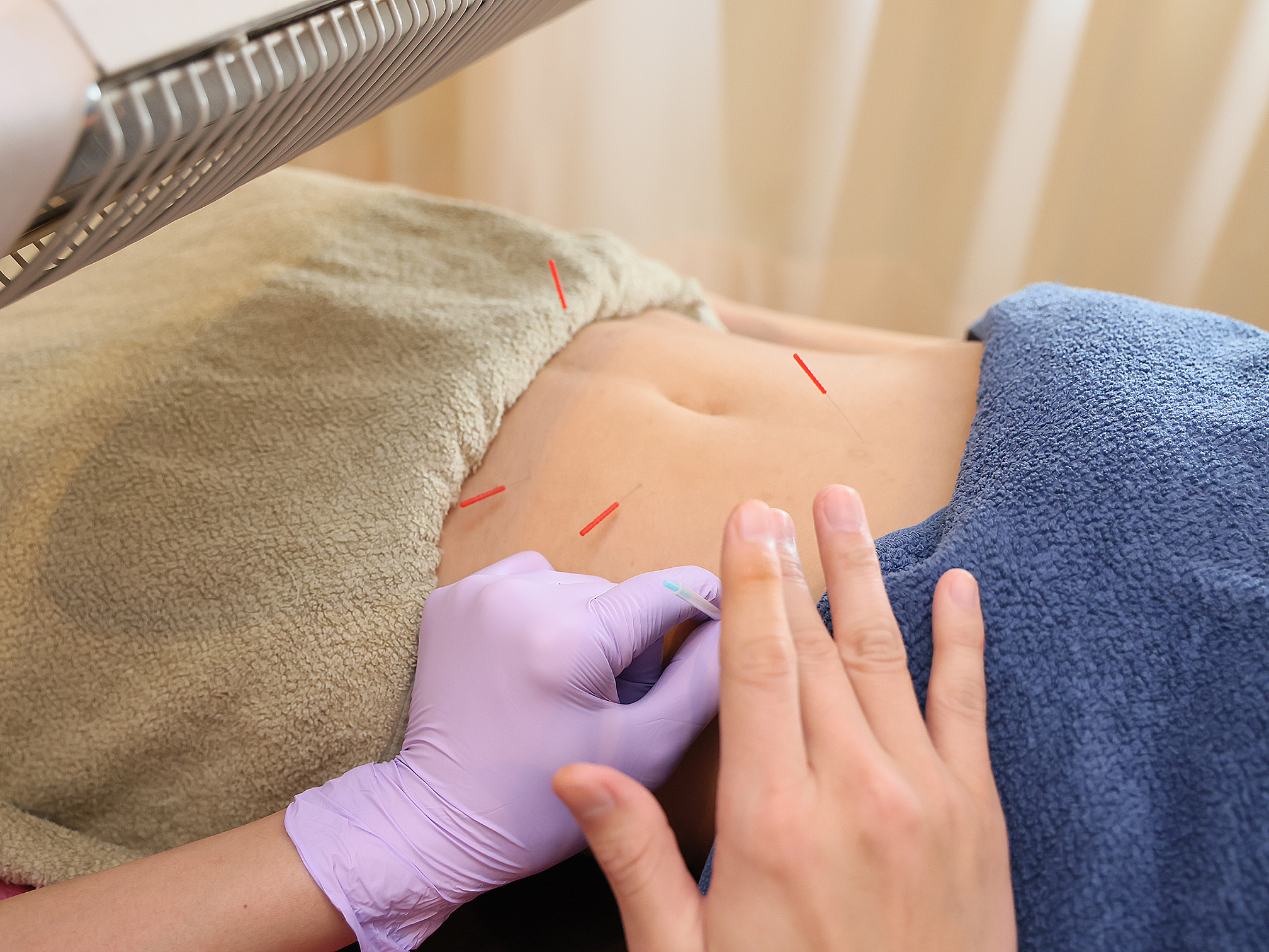 段上はり灸整骨院　自律神経・妊活・産前産後ケア 自律神経調整鍼灸コースのメニュー画像