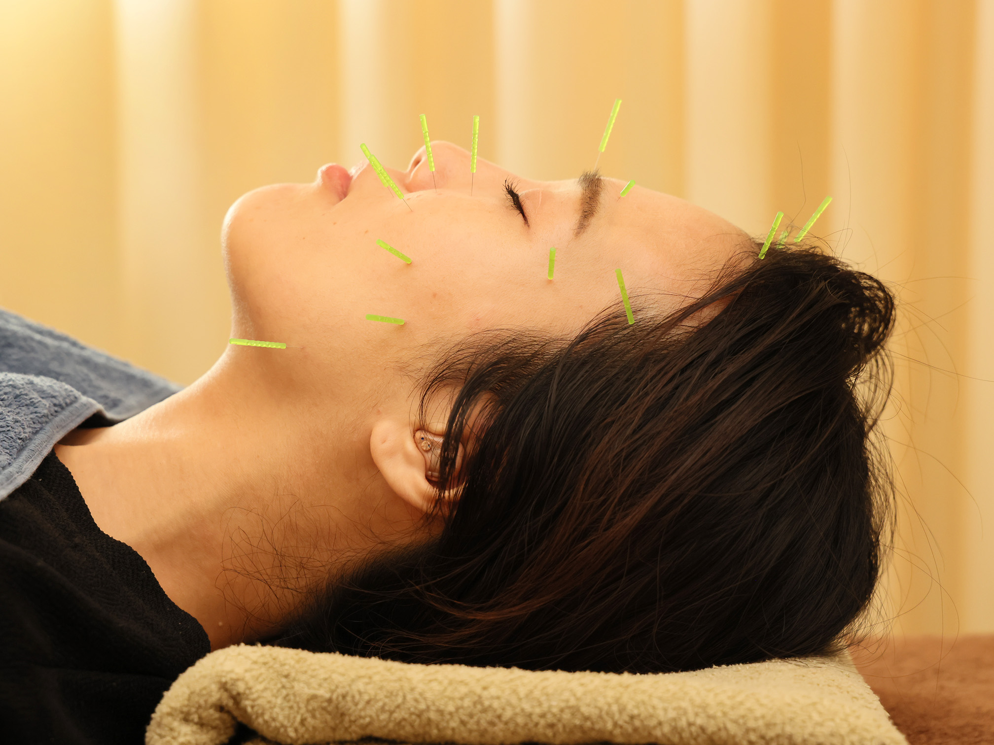 段上はり灸整骨院　自律神経・妊活・産前産後ケア 美容鍼｜全身ケアコースのメニュー画像