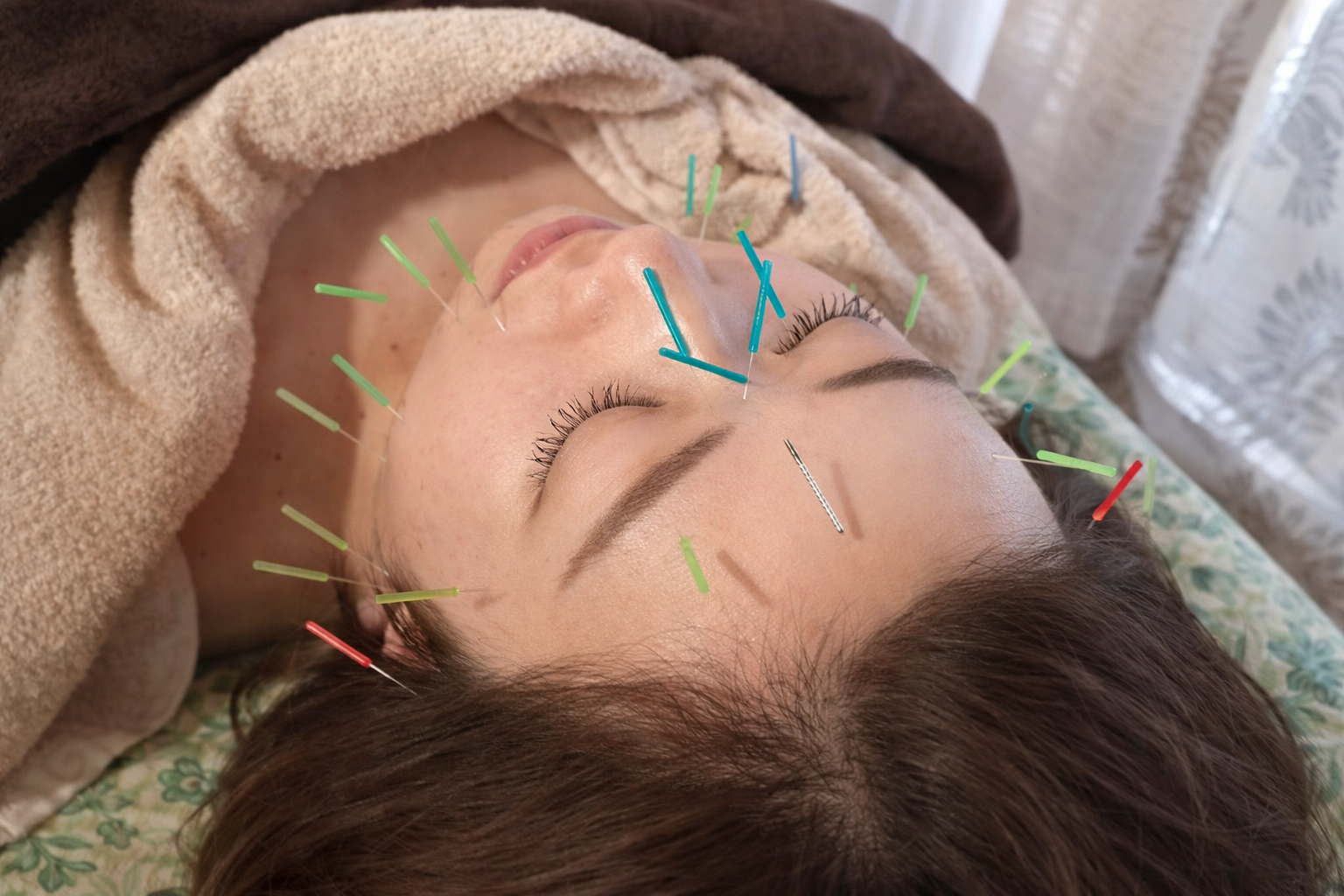 鍼灸サロンKanaloa 美容鍼トライアルコース（初回限定）のメニュー画像