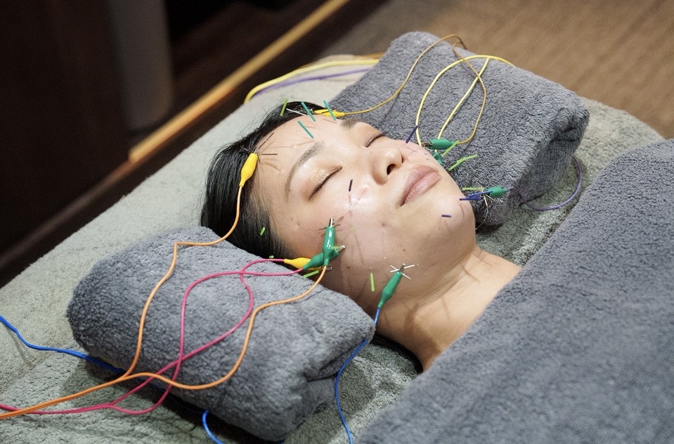  鍼灸まほろば KAGARI-Bi −Beauty & Body Care− 1番人気🎶【初回】リフトアップ美容鍼＆全身鍼 11,500円→5,900円‼️（2/28まで限定）のメニュー画像