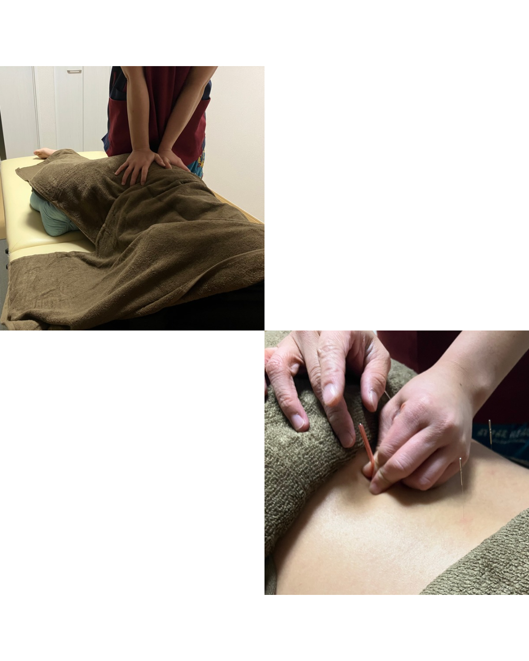 湯結鍼灸院 45分コースのメニュー画像