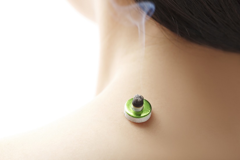 本気で治したい人のための　なごみ鍼灸整骨院 　ー東洋医学 × 根本改善 ― お灸治療１部位[部位数によって金額は異なります]のメニュー画像