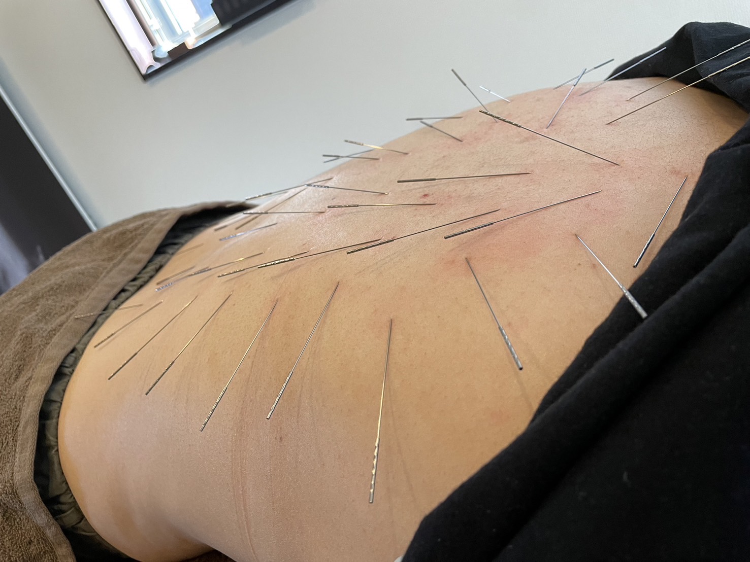 ここゆ鍼灸院 根本集中治療90分のメニュー画像